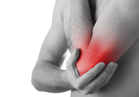 Inchaço e dor aguda na articulação são sinais do último estágio da artrose